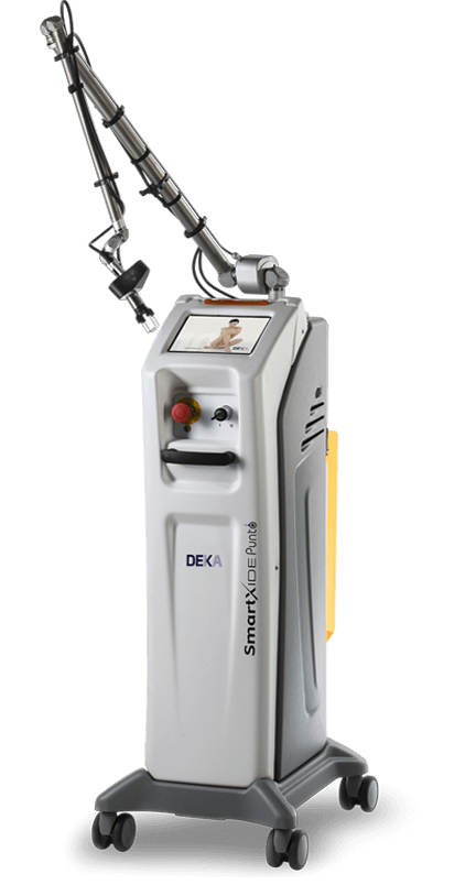 Smartxide Punto Smartxide Punto