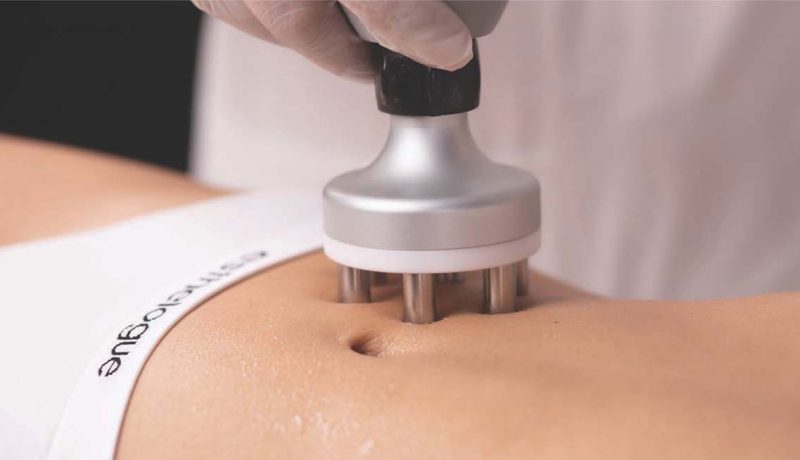 ThermActiveFoto ThermActiveFoto