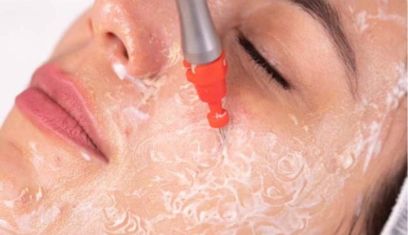 ThermActiveFoto6 ThermActiveFoto6